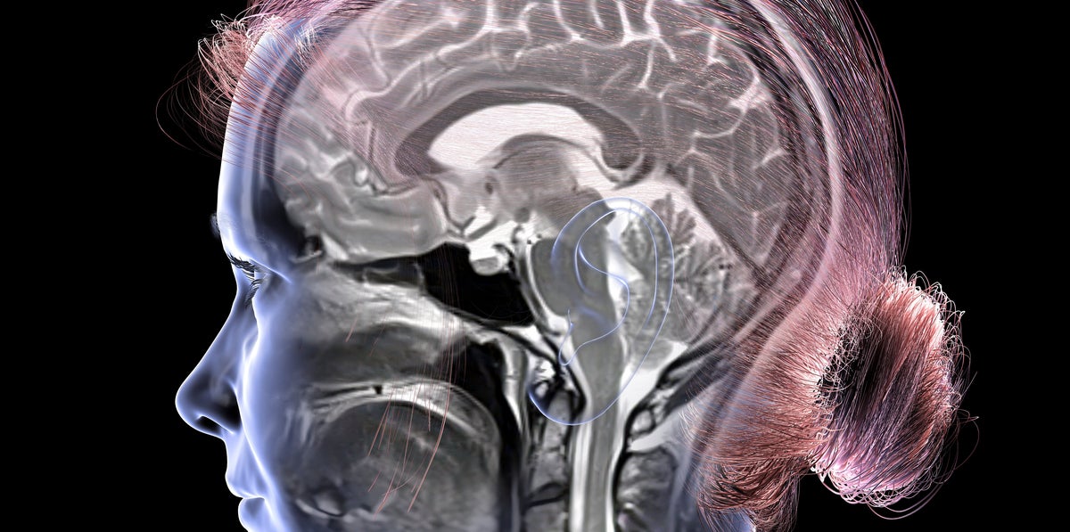 Weekly Exercise Preserves Brain Youth, Study Reveals